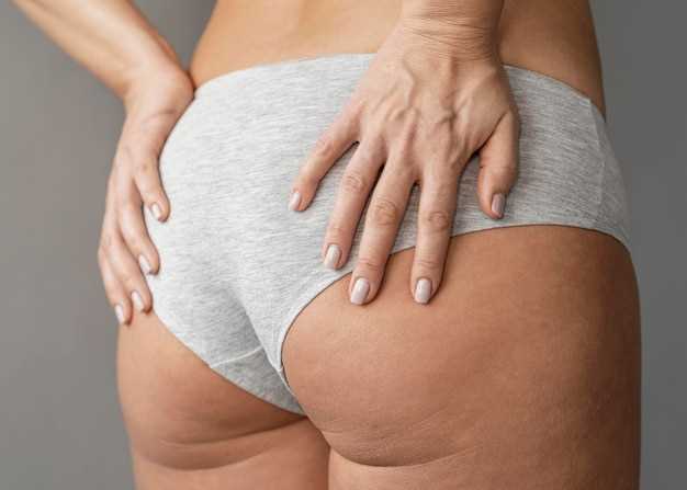 Эффективные способы борьбы с целлюлитом в домашних условиях