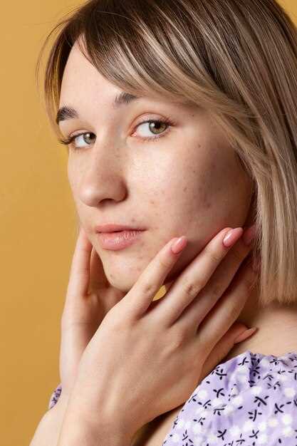 Почему сухая кожа может быть следствием недостатка витаминов?