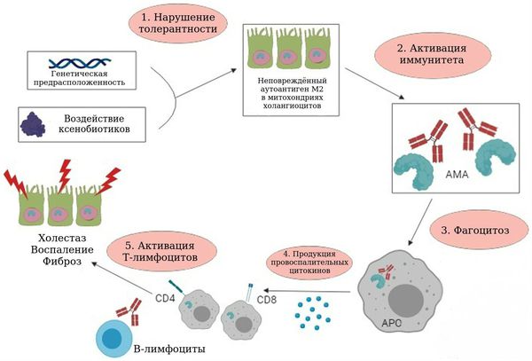 Патогенез первичного билиарного холангита