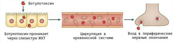 Распространение ботулотоксина в организме